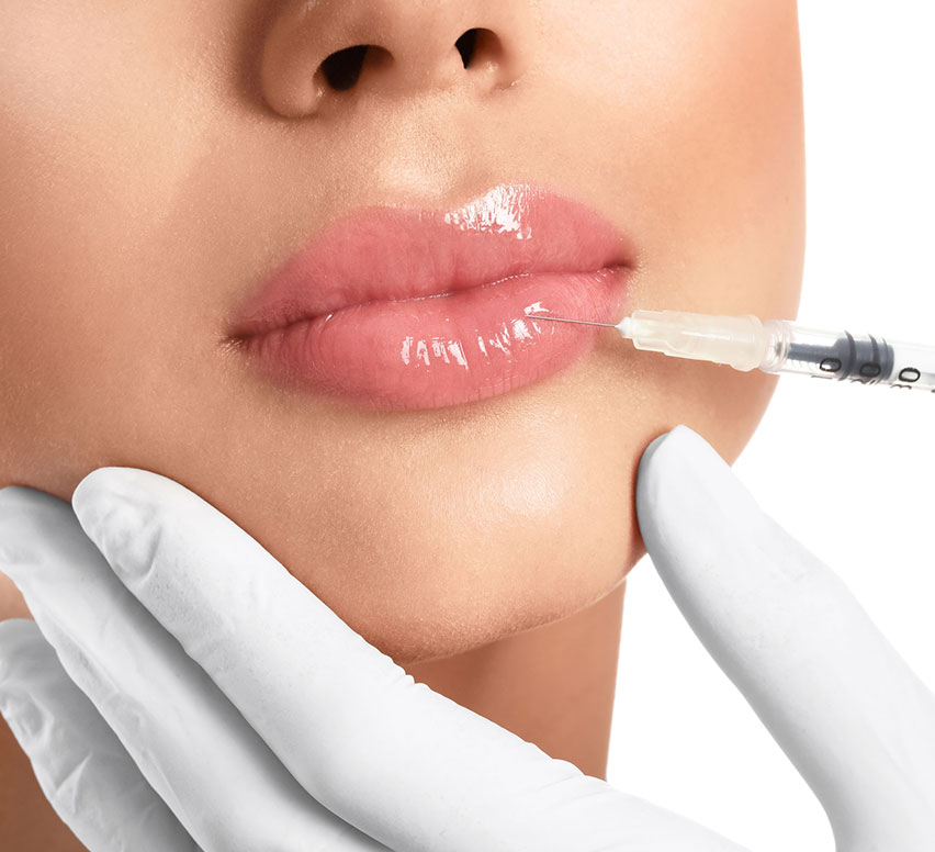 Dermal Fillers treatment in delhi