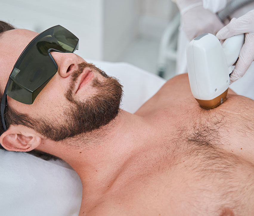Laser Hair Reduction